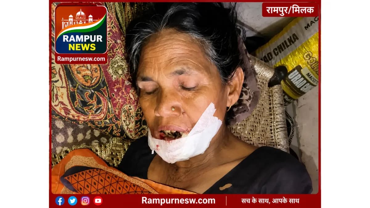 रामपुर: मिलक में आशा कार्यकर्ता पर जंगली गीदड़ का हमला, महिला गंभीर रू